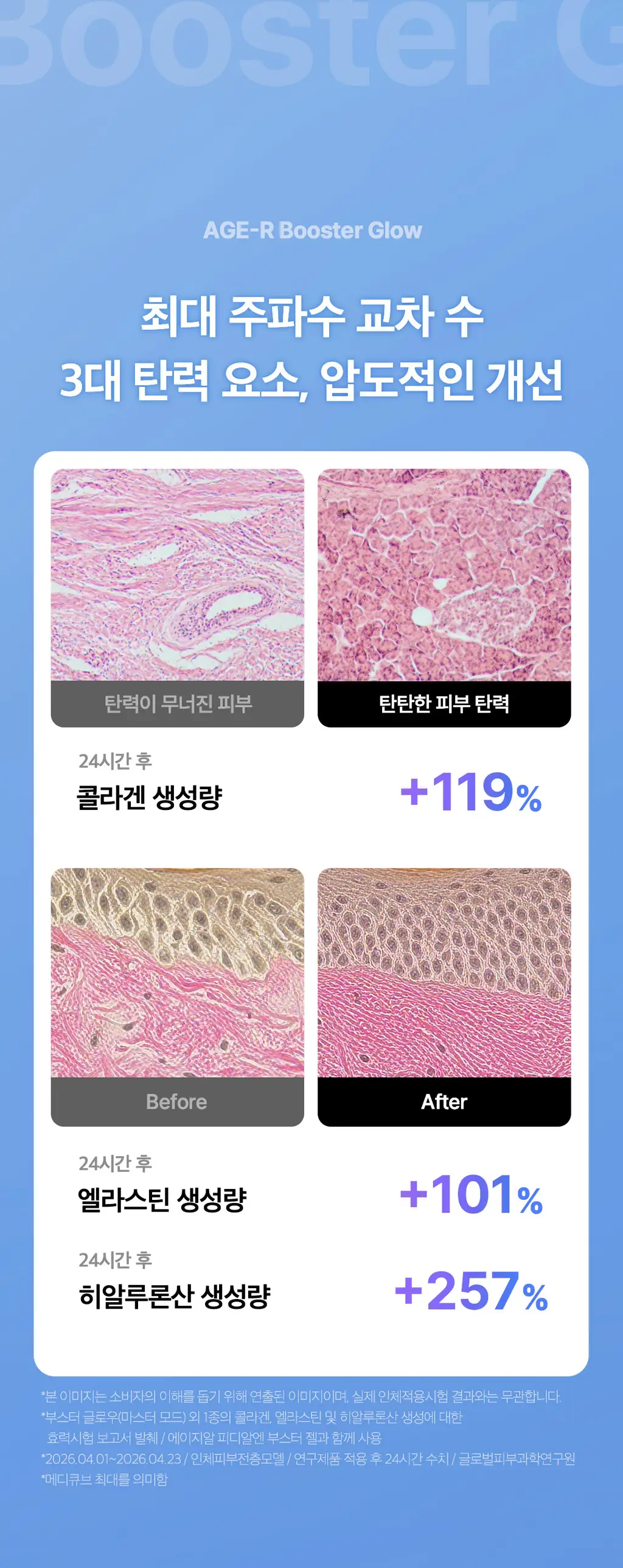 [7월 올영픽] [물방울초음파] 메디큐브 에이지알 부스터 글로우 (로즈핑크/그레이) 상세페이지 32